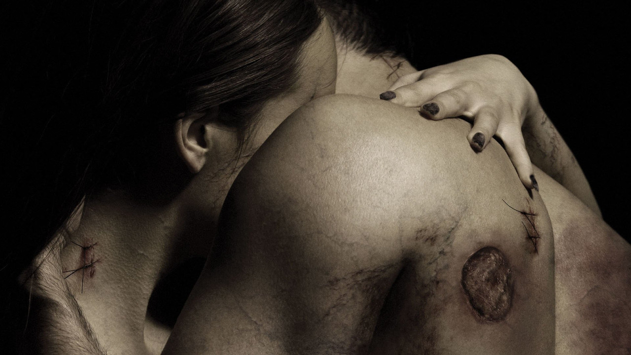 Contracted Collection background